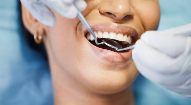 Best Emergency Gum Treatment in Highland, KS